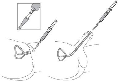 Establishment of drug solutions in urea